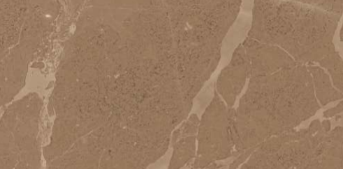 600 X 1200 mm Arenisca Tusky Glazed Vitrified Floor Tile - Glossy Finish